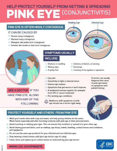 Pink Eye: Usually Mild and Easy to Treat - Appletree Day Care, Inc